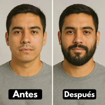 1 Bálsamo de minoxidil al 20% cerrar huecos barba y bigote - Maximus Inc