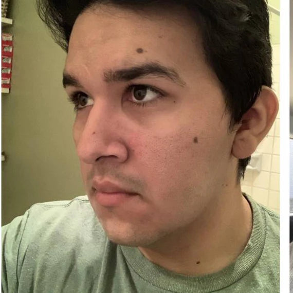 image comparison before