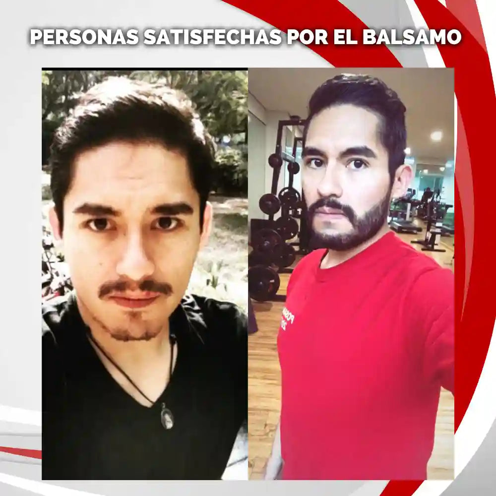 Bálsamo de minoxidil al 20% cerrar huecos barba y bigote