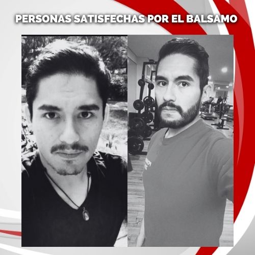 2 Bálsamos de minoxidil al 20% + GRATIS 1 Aceite Citrix Bergamota - Maximus Inc