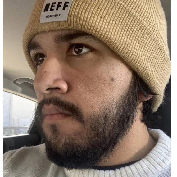 image comparison after