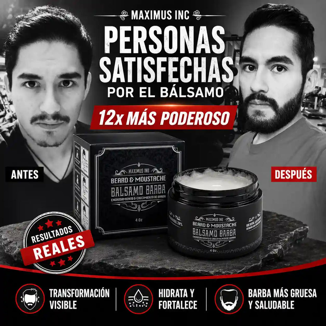 ULTRA FUERTE | Bálsamo para Crecimiento de Barba y Bigote Intensivo Minoxidil 20% | 120ml