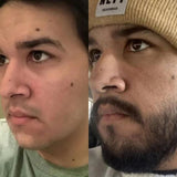 Bálsamo Minoxidil 20% para Barba y Bigote
