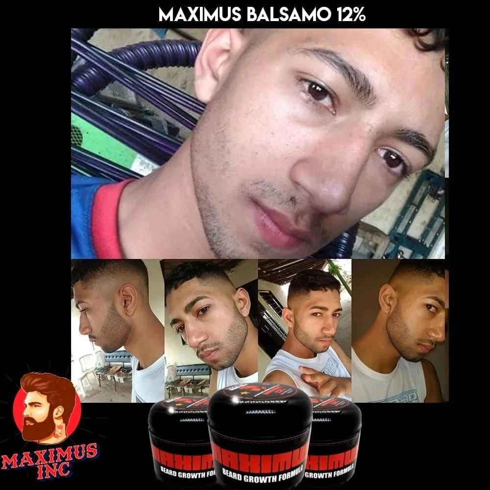 Bálsamo de minoxidil al 12% - 4 oz - crecimiento de barba y bigote extra fuerte - Maximus Inc