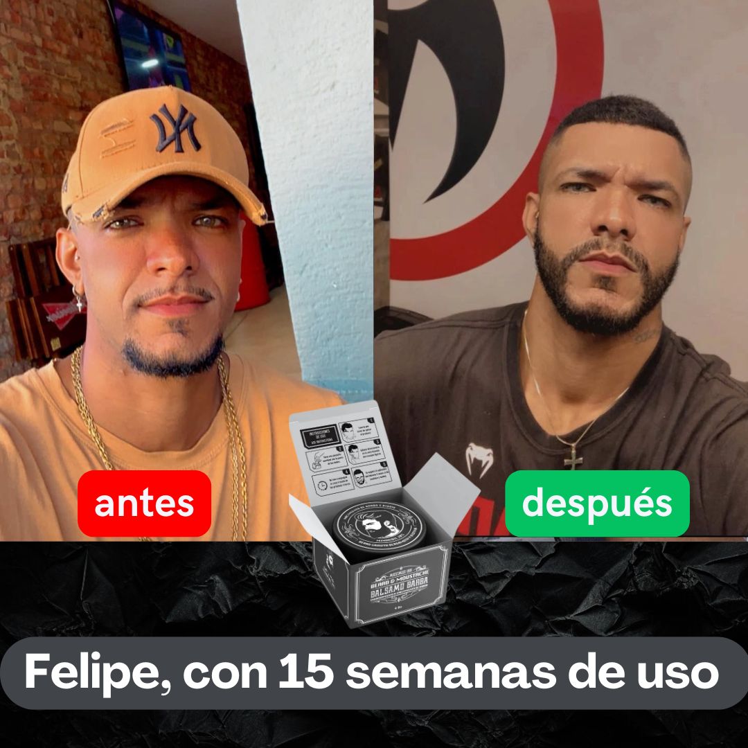 Bálsamo de minoxidil al 20% cerrar huecos barba y bigote - Maximus Inc