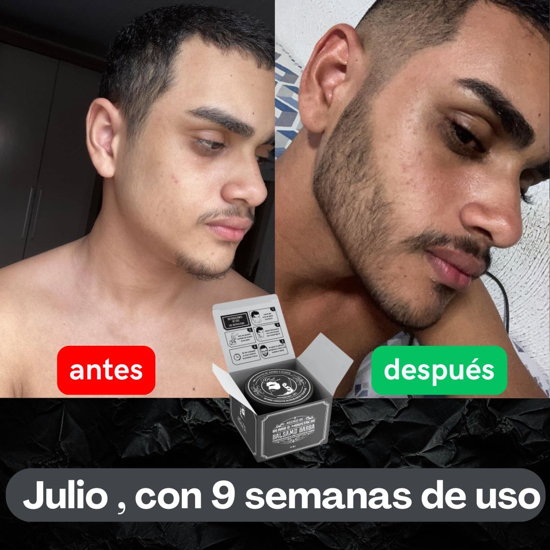 Bálsamo de minoxidil al 20% cerrar huecos barba y bigote - Maximus Inc