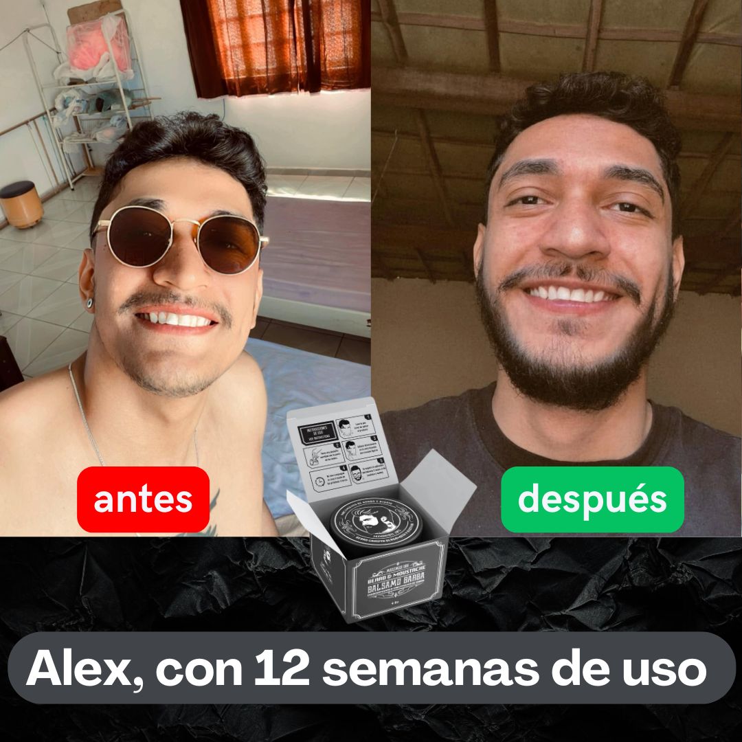 Bálsamo de minoxidil al 20% cerrar huecos barba y bigote - Maximus Inc