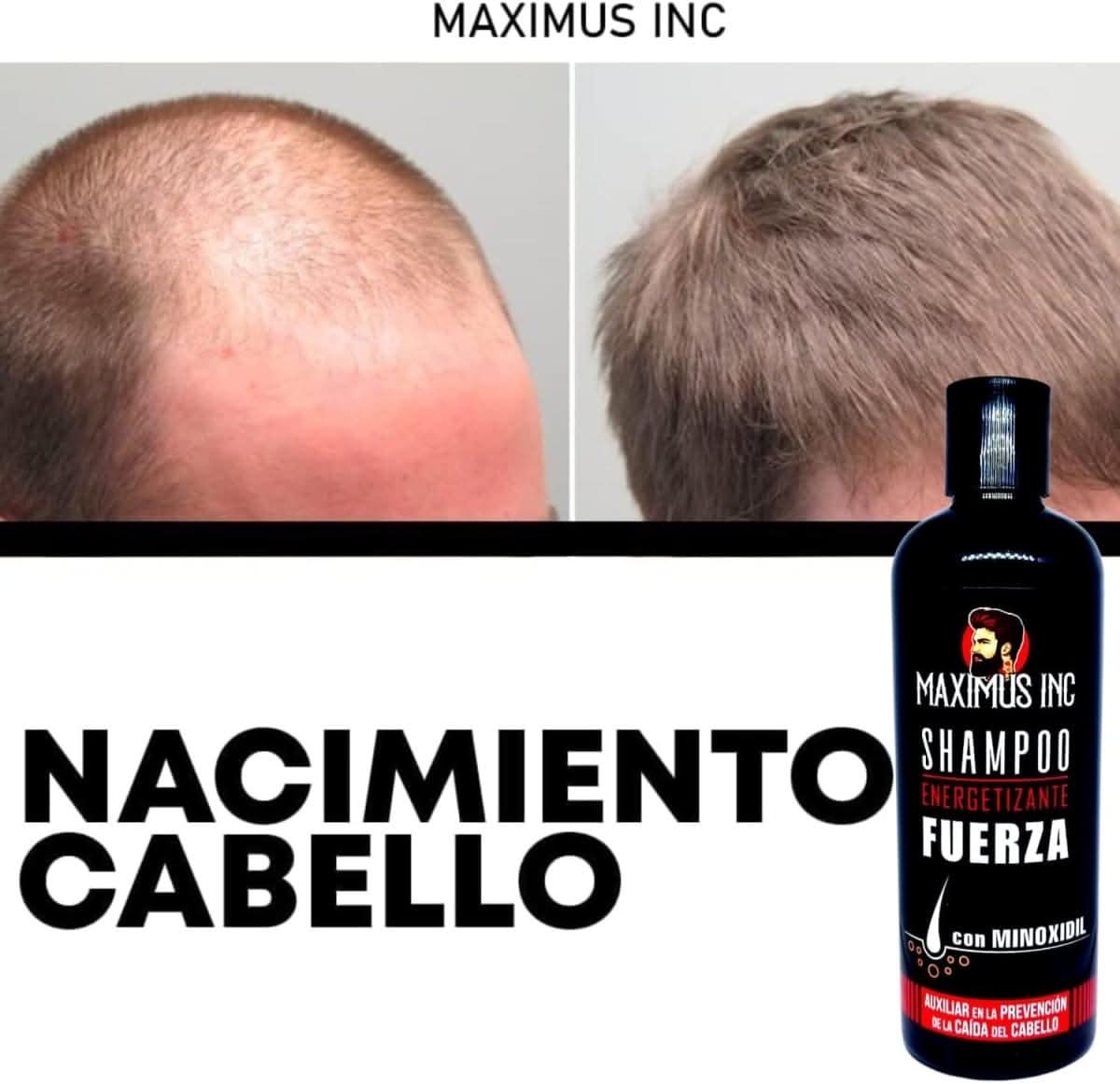 Shampoo con minoxidil 5% 500 ml - anticaída - crecimiento capilar - Maximus Inc