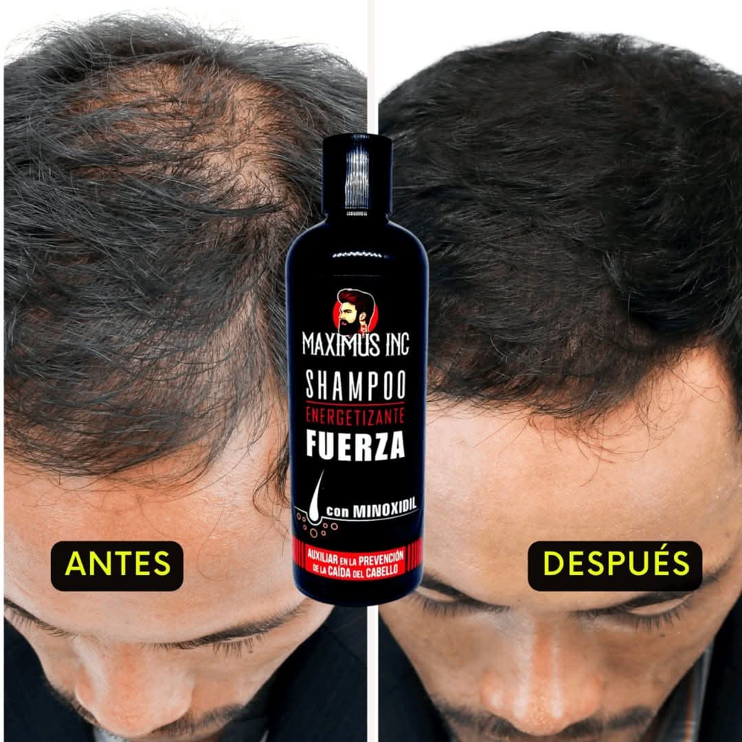 Shampoo con minoxidil 5% 500 ml - anticaída - crecimiento capilar - Maximus Inc