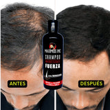 Shampoo con MINOXIDIL 5% 500 Ml- Shampoo Anticaída - Combate la Alopecia - Energizante Capilar - Anti Hair Loss Treatment Men - Crecimiento acelerado - Natural y Artesanal - Crecimiento Capilar - Maximus Inc