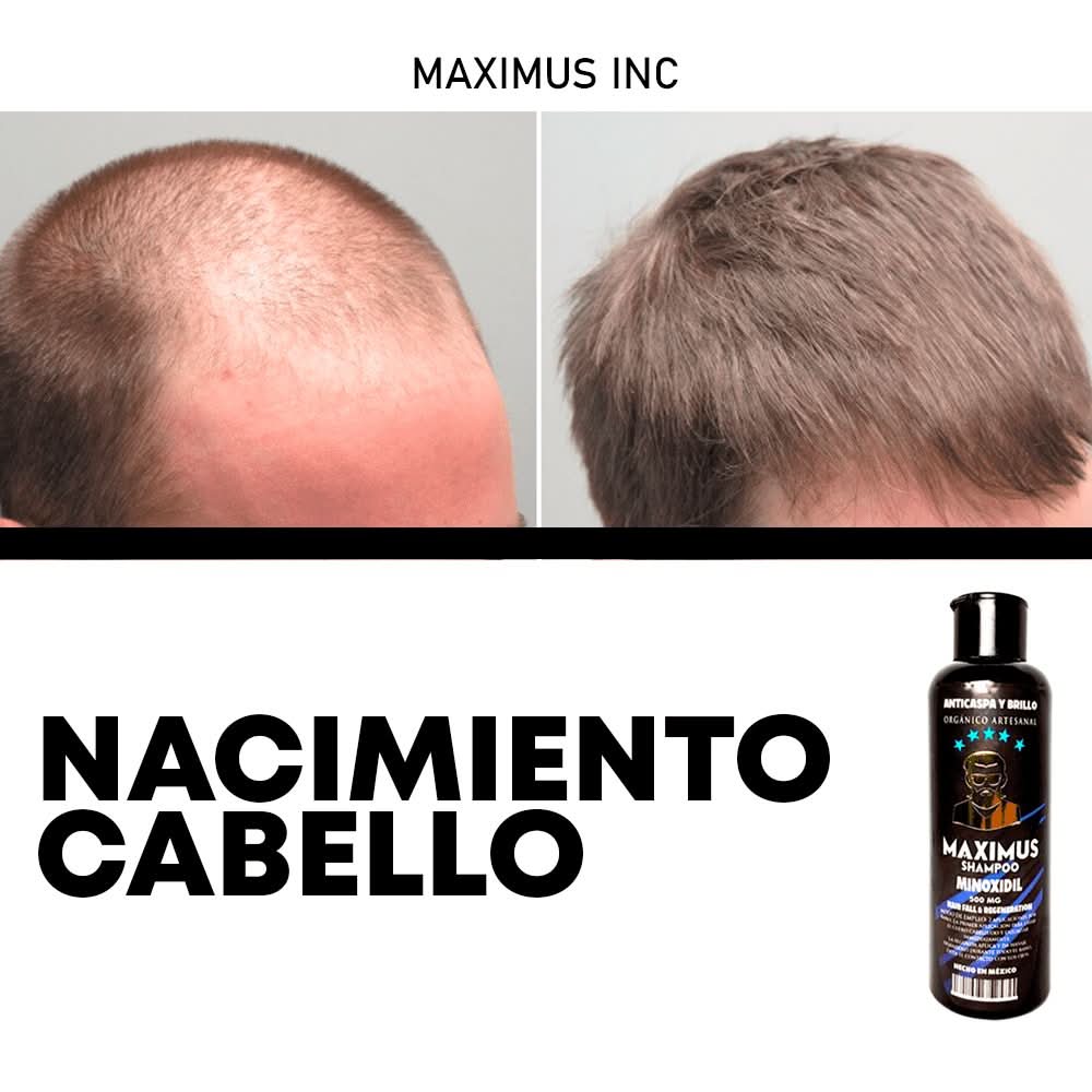 Shampoo minoxidil control caida cabello - 500 ml - Maximus Inc